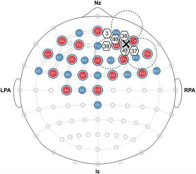 Tackling social anxiety with targeted brain stimulation: investigating the effects of transcranial static magnetic field stimulation on self-focused attention